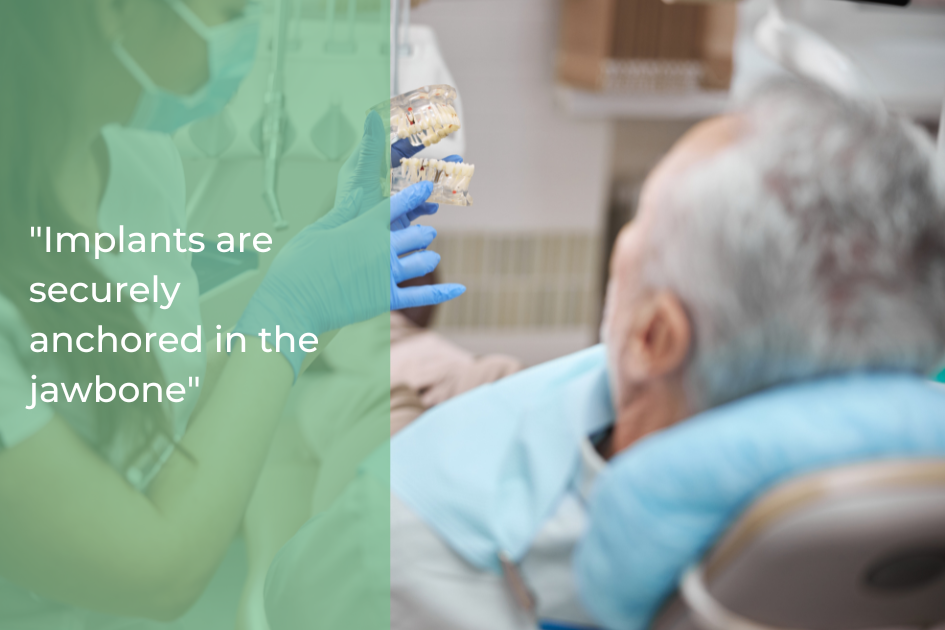 A dentist shows a Dental Implants model to an older male patient seated in a dental chair; text reads, "Implants are a long-term solution securely anchored in the jawbone.