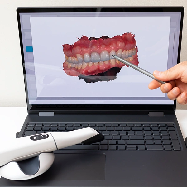 Advanced Cavity Detection Technology